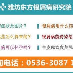 潍坊牛皮癣专业医院潍坊东方